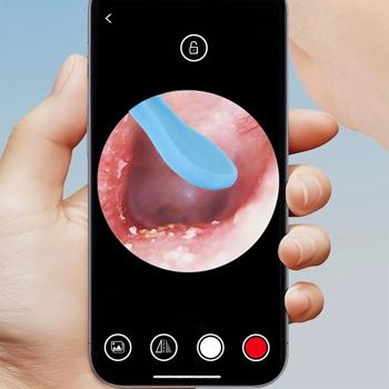 Preview: Nettoyeur d’oreille sans fil avec caméra, 14 pièces – cure-oreille intelligent avec caméra de 8 MP, lampe LED, visionnage en direct sur smartphone