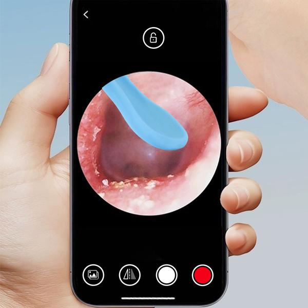 Pulitore auricolare ricaricabile con telecamera, 14 pezzi Soluzione innovativa e indolore per una pulizia dell‘orecchio sicura ed efficace